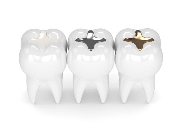 Dental filling