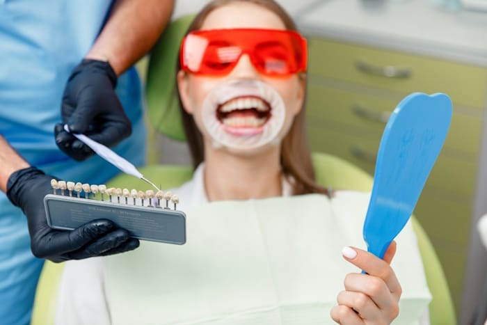 coloured teeth whitening